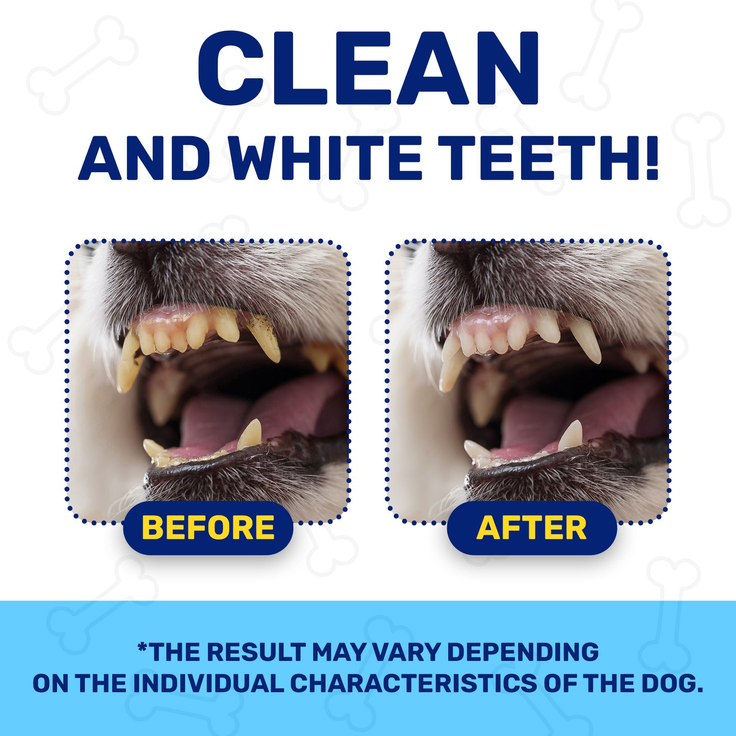 Dental Powder